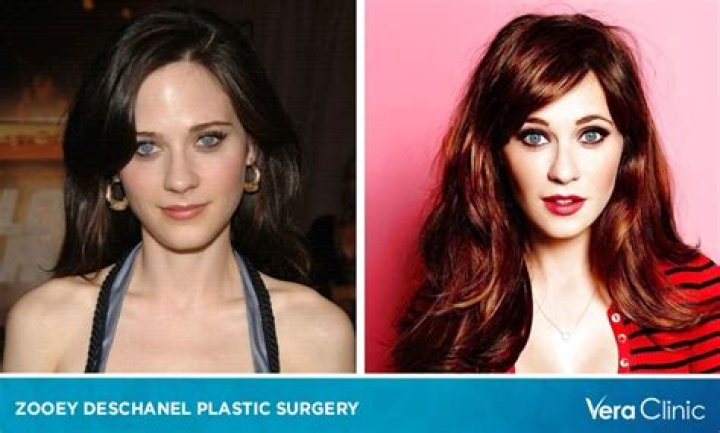 Did Zooey Deschanel Get a Plastic Surgery? Facts Behind The Rumors