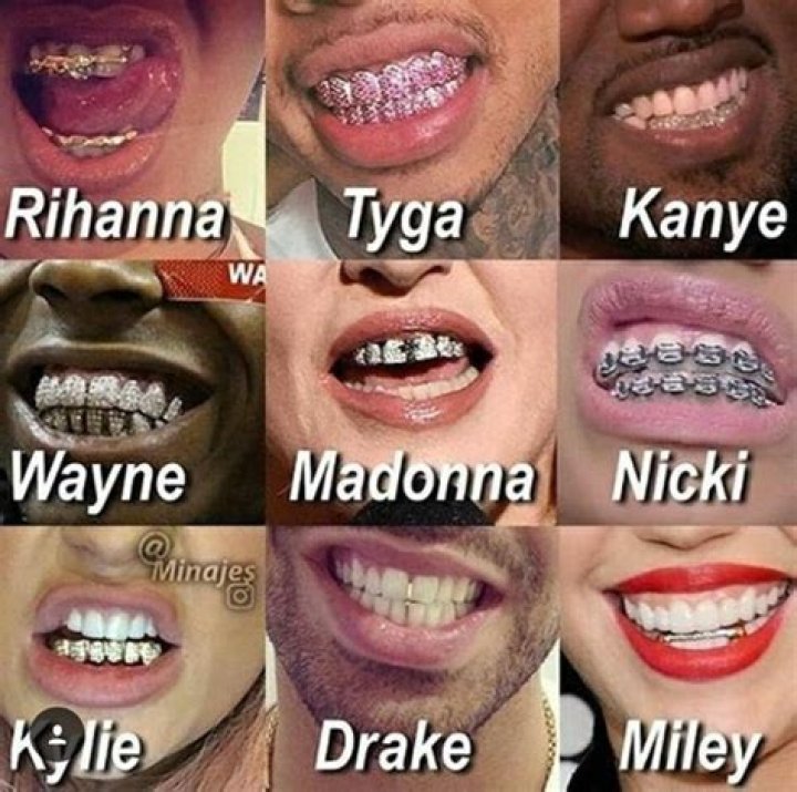 Unveiling The Allure Of Grillz: Discoveries And Insights