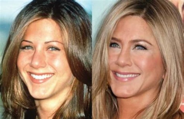 Jennifer Aniston Nose Job And Plastic Surgery Before And After Photos
