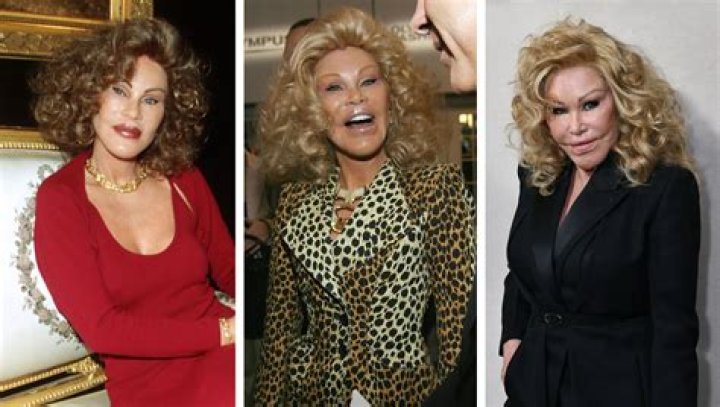 Unveiling The Enigmatic Jocelyn Wildenstein: Uncovering Secrets And Surprises