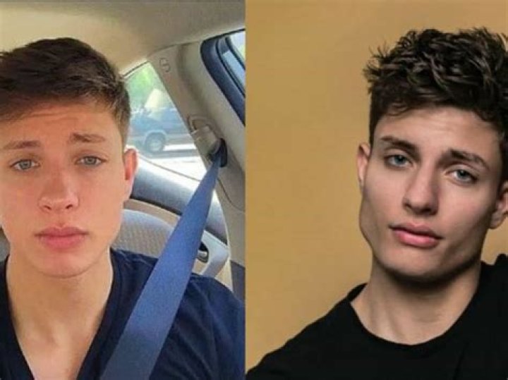 Unveiling Matt Rife's Dental Transformation: A Journey Of Smiles
