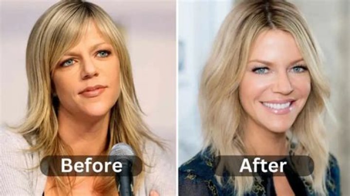 Fans Suspect Jaw Surgery ·