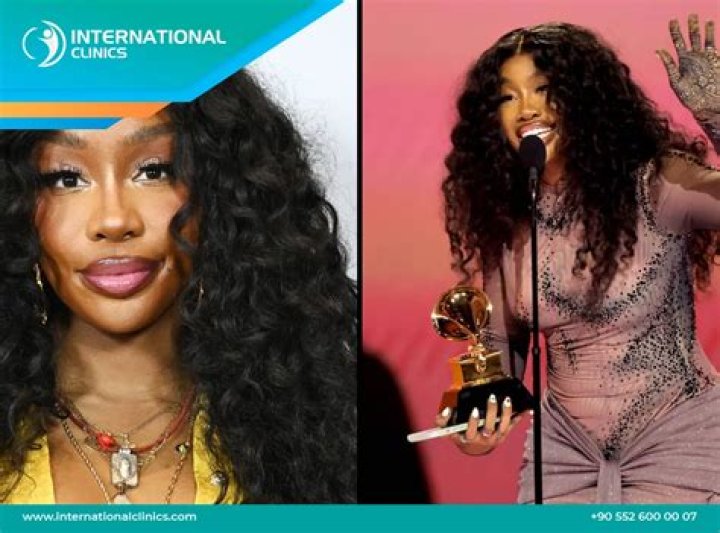 SZA Before Surgery: How the Singer Transformed Her Looks and Voice